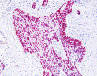 Napsin A/p40 detection reagent (Immunohistochemical)