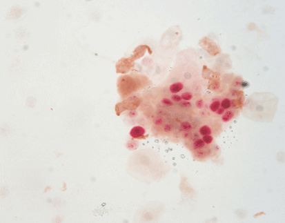 [Red/Brown] P16/Ki-67 Dual Staining Detection Kit