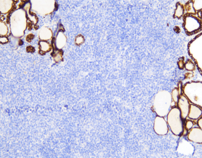 Thyroid Peroxidase/TPO (C3B12), MMab