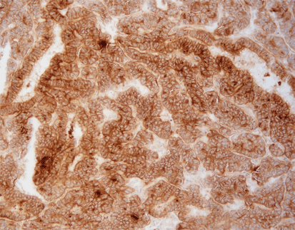 Galectin-3(EP412),RMab