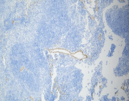 [RX] MicroStacker™ Mouse-on-Mouse HRP Polymer