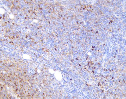 Kappa Light Chain(C8H10),MMab