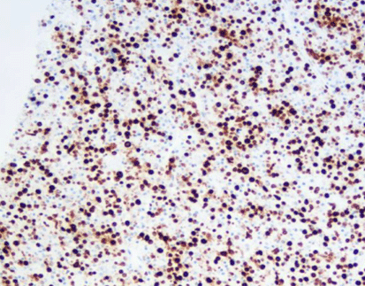 [Onboard] MicroStacker™ Flex Polymer Detection Kit