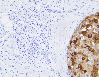 Mammaglobin(EP249),RMab