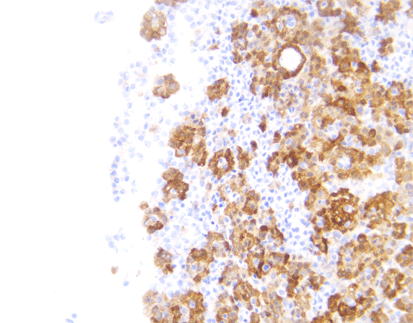 Calretinin(C5G4),MMab