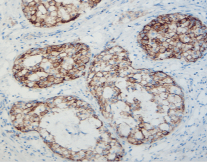 [Onboard] MicroStacker™ Plus Polymer Detection Kit