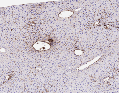 [RX] MicroStacker™ Rabbit-on-Rodent HRP-Polymer