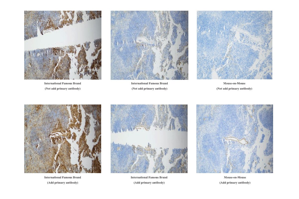 Mouse spleen stained with SMA antibody using MicroStacker™ kit