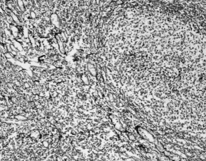 Reticular Fiber Staining Kit