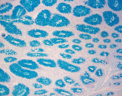 Alcian Blue (pH 1.0) Stain Kit