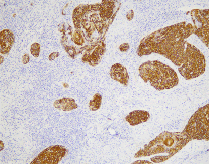 Cytokeratin 19(A53-B/A2.26),MMab