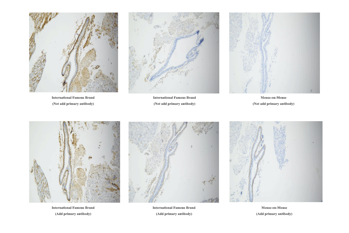 Mouse kidney stained with SMA antibody using MicroStacker™ kit