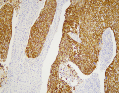 Cytokeratin 7 (C1C10),MMab