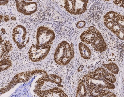 Mismatch Repair Protein(MLH1)-IHC primary antibody