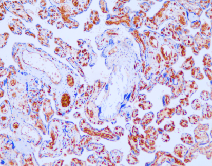 Alpha-1-Fetoprotein (C1B1),MMab