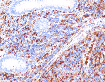 Annexin A1(C5F8),MMab