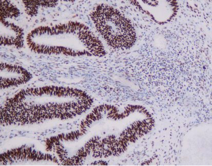 MMR panel | MSH2 (C2G3), MMab