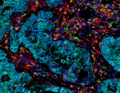 Multiplex Immunofluorescence(mIF) Kit