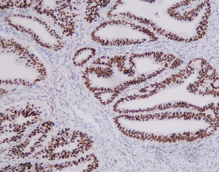 MMR panel | MLH1 (C12A19), MMab