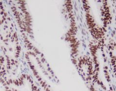 MMR panel | MSH6 (C5D11), MMab