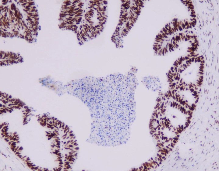 MMR panel | PMS2 (MRQ-28), MMab