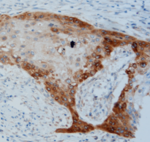 MicroStacker Enhanced detection - D2-40