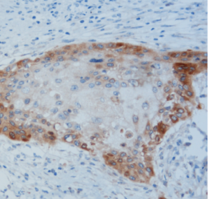 REAL EnVision detection - D2-40