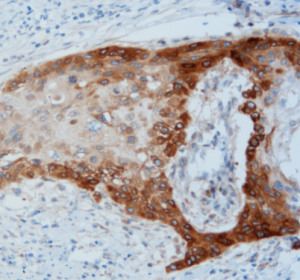 EnVision Flex + Mouse Linker detection - D2-40