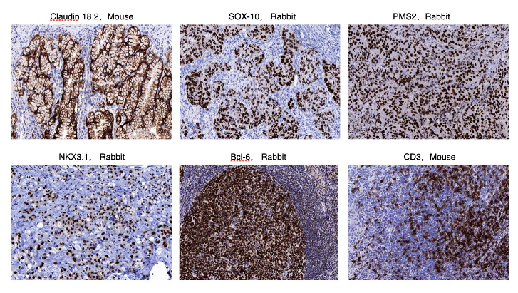 MicroStacker™ Ultra Polymer Detection Kit - IHC Stainer Compatibility