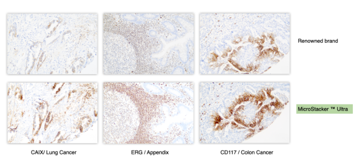 MicroStacker™ Ultra Polymer Detection Kit - Consistent Staining Performance