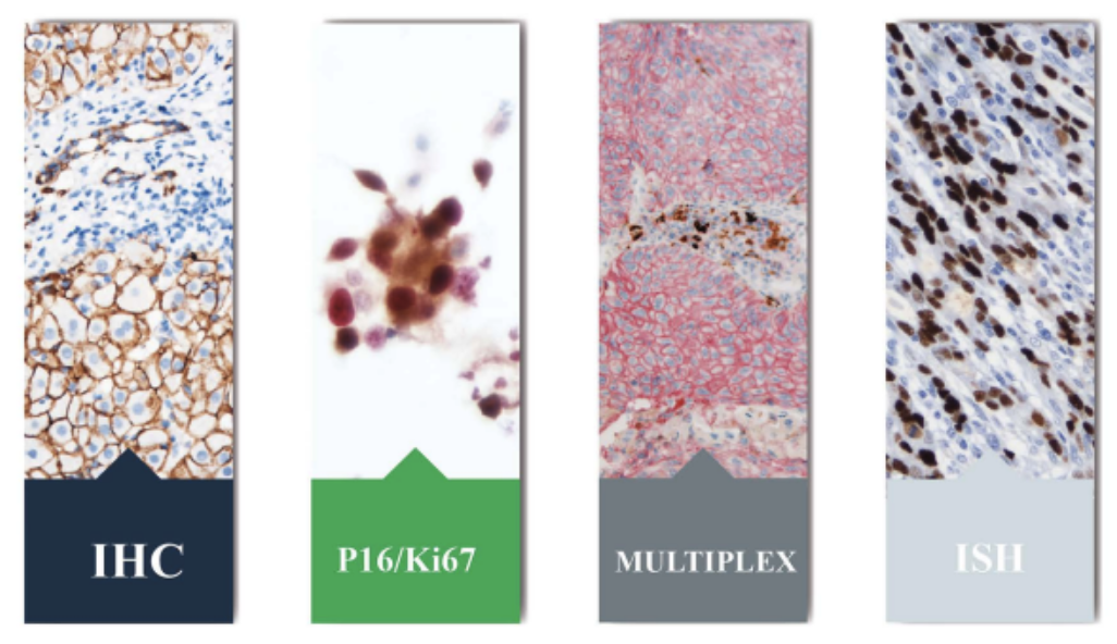 CNT300 Full Automatic Multiplex IHC Stainer interface showcasing intuitive software and reliability